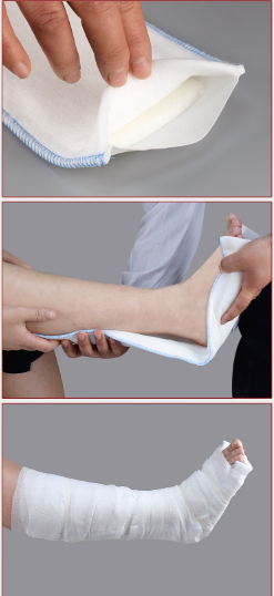 Immobility Splint Eco-Friendly Fast-Setting Medical Polymer Splint for Joint ...