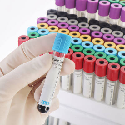 Buy Vacuum EDTA Blood Tubes for Complete Blood Count (CBC) – High Quality, Secure Seal online manufacture